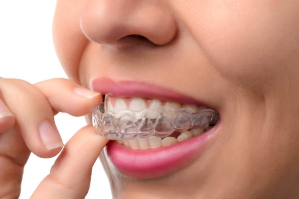 Myths About Traditional Metal Braces - Smiles Orthodontics