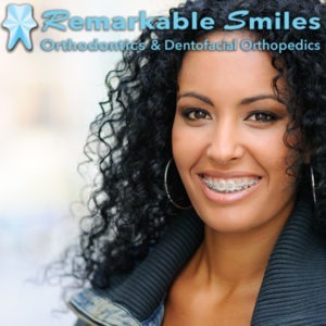 Braces deals anaheim ca