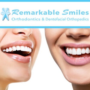 Myths About Traditional Metal Braces - Smiles Orthodontics