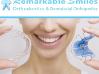 The risks of self-applied braces and clear aligners
