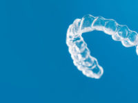 Why are DIY Clear Aligners a bad choice?
