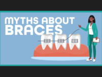 Debunking Braces Myths: Dispelling Common Misconceptions